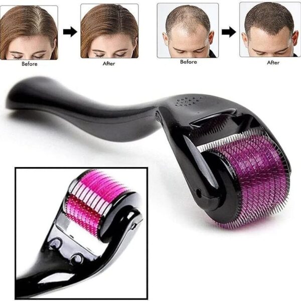 Derma Roller Pour La Croissance Des Cheveux 0,5 Mm Avec Aiguilles En Titane – Active Les Follicules Pileux Pour La Perte et L’épaisseur Des Cheveux – Réduit Les Cicatrices D’acné